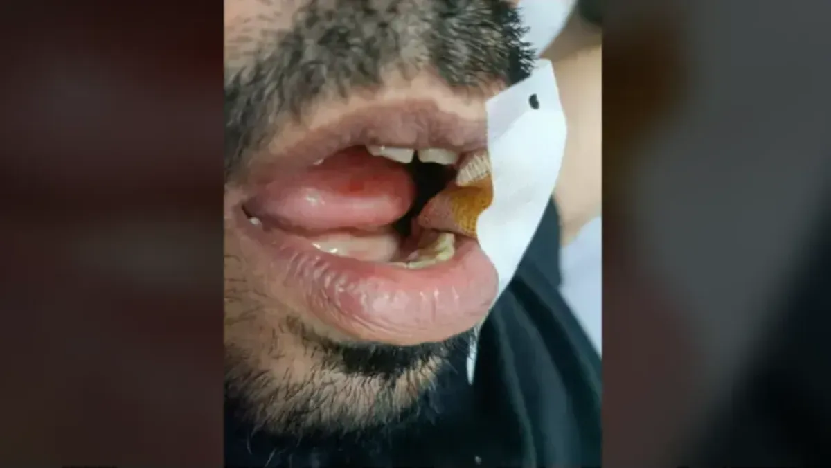 تحويل طالب اعتدى على أستاذ بمدرسة وهران بعد إصابة خطيرة